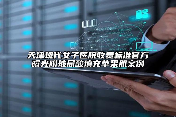 天津现代女子医院收费标准官方曝光附玻尿酸填充苹果肌案例