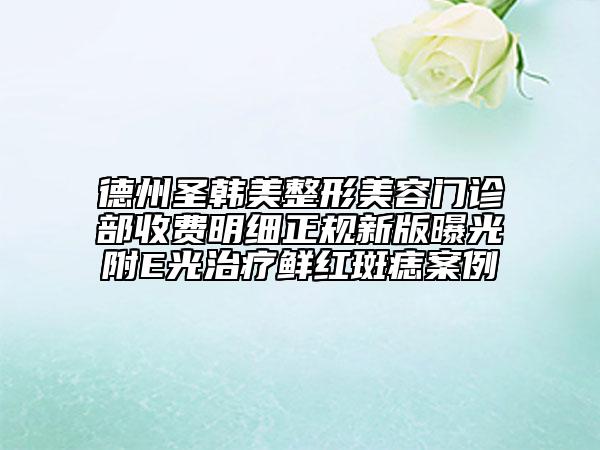 德州圣韩美整形美容门诊部收费明细正规新版曝光附E光治疗鲜红斑痣案例