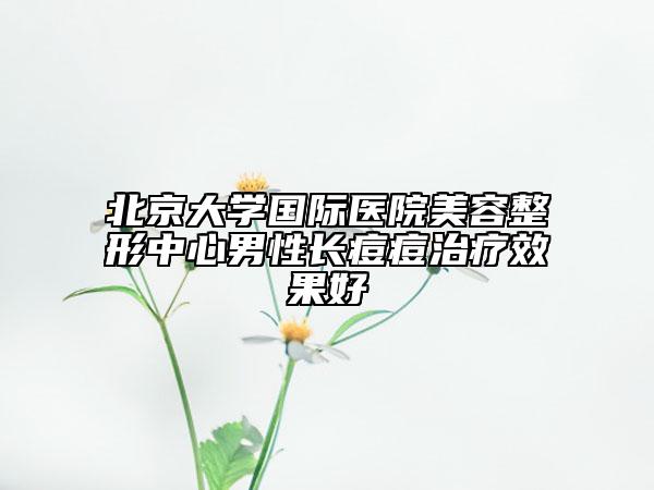 北京大学国际医院美容整形中心男性长痘痘治疗效果好