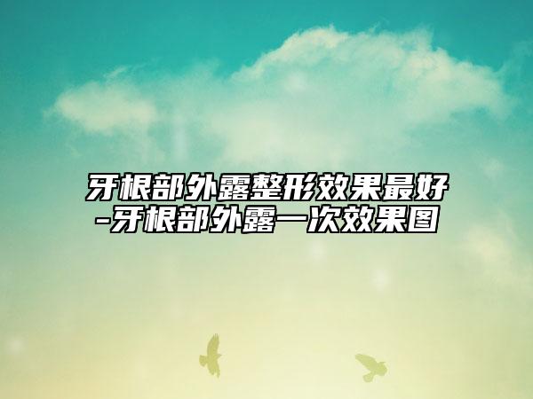 牙根部外露整形效果最好-牙根部外露一次效果图