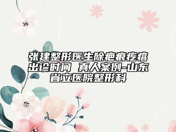 张建整形医生除疤痕疙瘩出诊时间 真人案例-山东省立医院整形科
