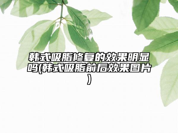 韩式吸脂修复的效果明显吗(韩式吸脂前后效果图片)