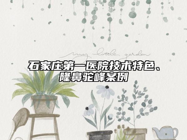 石家庄第一医院技术特色、隆鼻驼峰案例