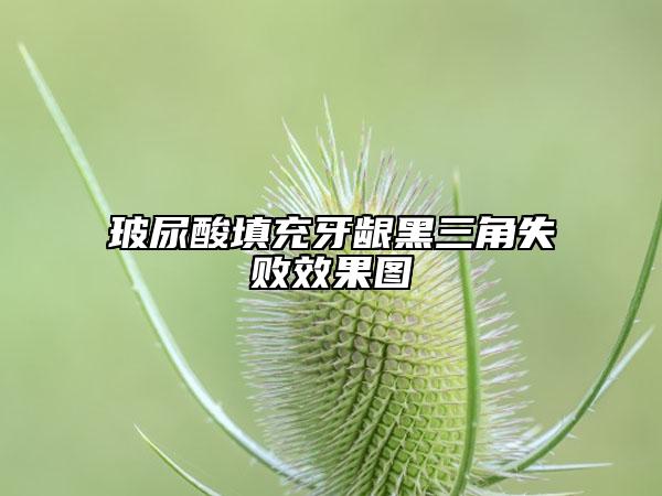 玻尿酸填充牙龈黑三角失败效果图