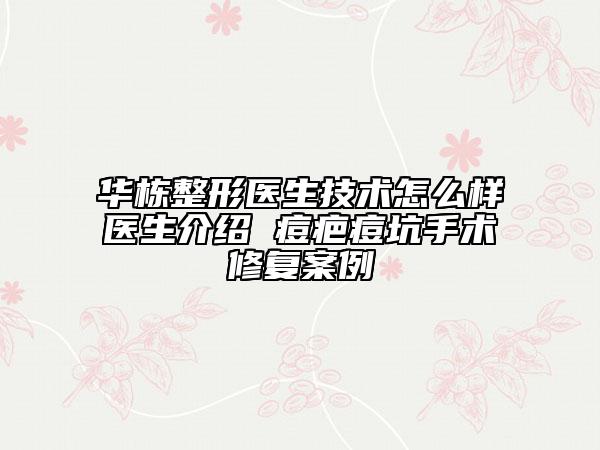 华栋整形医生技术怎么样医生介绍 痘疤痘坑手术修复案例