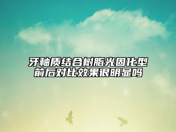牙釉质结合树脂光固化型前后对比效果很明显吗